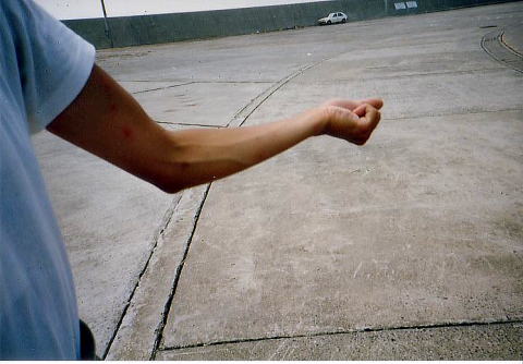 痒いところがどんどん増えていく!